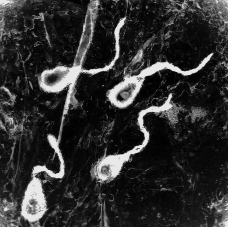 sperm, 1999, Photography